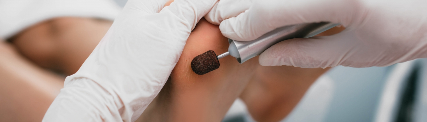 medisch pedicure amsterdam