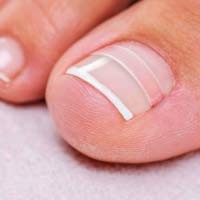 medisch pedicure amsterdam